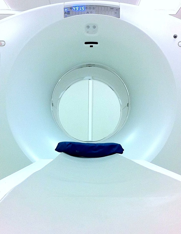 CT-SCAN